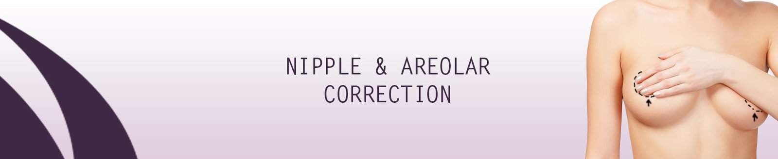 areolar
